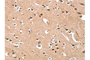 The image on the left is immunohistochemistry of paraffin-embedded Human brain tissue using ABIN7190421(CYP46A1 Antibody) at dilution 1/15, on the right is treated with synthetic peptide. (CYP46A1 antibody)