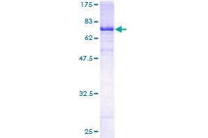 Image no. 1 for Transducin-Like Enhancer of Split 6 (TLE6) (AA 1-449) protein (GST tag) (ABIN1322841)