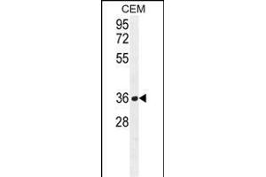 NUDT22 Antibody (C-term) (ABIN655227 and ABIN2844833) western blot analysis in CEM cell line lysates (35 μg/lane). (NUDT22 antibody  (C-Term))