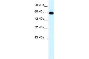 Western Blotting (WB) image for anti-GLIS Family Zinc Finger 2 (GLIS2) antibody (ABIN2460154)