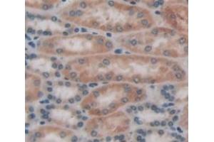 #VALUE! (FNTA antibody  (AA 51-366))