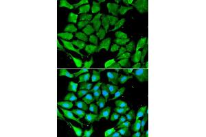 Immunofluorescence analysis of A549 cell using PPARG antibody. (PPARG antibody  (AA 50-150))