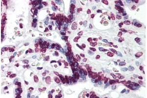 Human Placenta: Formalin-Fixed, Paraffin-Embedded (FFPE) (Aryl Hydrocarbon Receptor antibody  (AA 279-376))