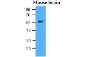 The extracts of Mouse brain (35 ug) were resolved by SDS-PAGE, transferred to PVDF membrane and probed with anti-human beta-Tubulin (1:10000). (TUBB antibody  (AA 1-445))