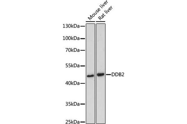 DDB2 antibody  (AA 1-315)