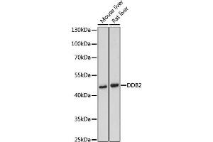 Western blot analysis of extracts of various cell lines, using DDB2 antibody (ABIN3022631, ABIN3022632, ABIN3022633 and ABIN6218976) at 1:500 dilution. (DDB2 antibody  (AA 1-315))