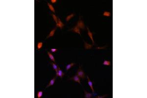 Immunofluorescence (IF) image for anti-Proteasome Subunit alpha  7 (PSMA7) (AA 1-248) antibody (ABIN1682332)