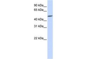 Image no. 1 for anti-Homeobox even-skipped homolog protein 2 (EVX2) (C-Term) antibody (ABIN6740651)