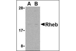 Western blot analysis of Rheb in rat heart cell lysate with this product at (A) 2 and (B) 4 μg/ml. (RHEB antibody  (N-Term))