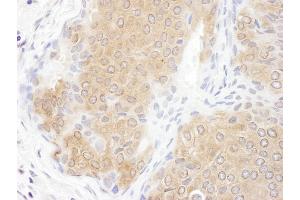 anti-Chaperonin Containing TCP1, Subunit 3 (Gamma) (CCT3) (AA 300-350) antibody