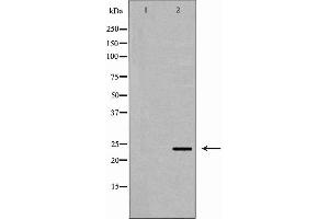 Western blot analysis of HepG2 cell lysate, using ORM1 Antibody.