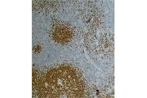 Immunohistochemistry (IHC) image for anti-Paired Box 5 (PAX5) antibody (ABIN2667347) (PAX5 antibody)