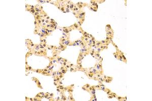 Immunohistochemistry of paraffin-embedded rat lung using SRSF1 Antibody (ABIN5970815) at dilution of 1/100 (40x lens).