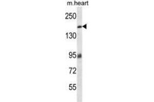 Western blot analysis in mouse heart tissue lysates (35ug/lane) using MYBPC3 Antibody (N-term).