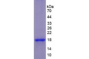 SDS-PAGE analysis of Human Keratin 1 Protein. (Cytokeratin 1 Protein)