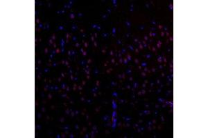 Immunofluorescent analysis of paraffin-embedded rat brain using EIF2S2 (ABIN7073880) at dilution of 1: 1000