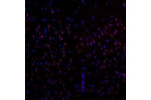 Immunofluorescent analysis of paraffin-embedded rat brain using EIF2S2 (ABIN7073880) at dilution of 1: 1000 (EIF2S2 antibody)