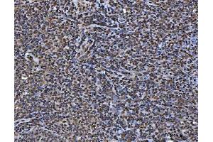 IHC analysis of TIP49A/RUVBL1 using anti-TIP49A/RUVBL1 antibody (ABIN7599928).