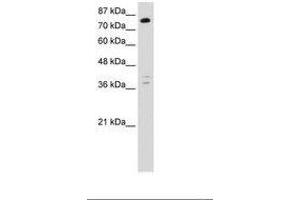 Image no. 1 for anti-TSC22 Domain Family, Member 2 (TSC22D2) (C-Term) antibody (ABIN6736248) (TSC22D2 antibody  (C-Term))
