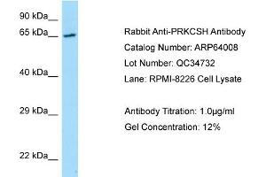 Western Blotting (WB) image for anti-Protein Kinase C Substrate 80K-H (PRKCSH) (N-Term) antibody (ABIN2789692) (PRKCSH antibody  (N-Term))