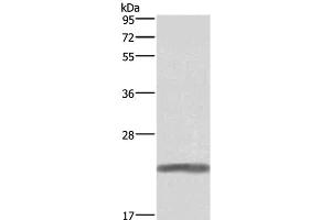 Western Blot analysis of Human placenta tissue using GH1 Polyclonal Antibody at dilution of 1:500 (Growth Hormone 1 antibody)