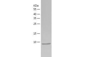 Western Blotting (WB) image for Zinc Finger Protein 75A (ZNF75A) (AA 58-162) protein (His tag) (ABIN7288422) (ZNF75A Protein (AA 58-162) (His tag))