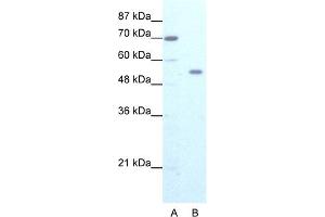 WB Suggested Anti-ZNF665 Antibody Titration:  1. (ZNF665 antibody  (N-Term))
