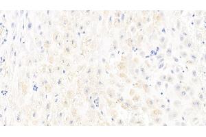 Immunohistochemistry (IHC) image for anti-Caspase 1 (CASP1) (AA 120-297) antibody (ABIN7437272)