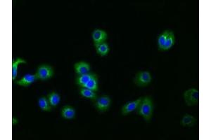Immunofluorescence staining of HepG2 cells with ABIN7127519 at 1:30, counter-stained with DAPI. (Recombinant Glypican 3 antibody)