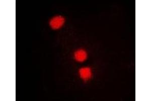 Immunofluorescent analysis of SMCHD1 staining in MCF7 cells. (SMCHD1 antibody)