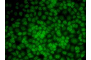 Immunofluorescence analysis of HeLa cells using UMPS antibody (ABIN5973202). (UMPS antibody)