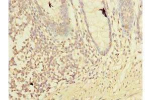 Immunohistochemistry of paraffin-embedded human colon tissue using ABIN7158359 at dilution of 1:100 (LMO3 antibody  (AA 1-145))