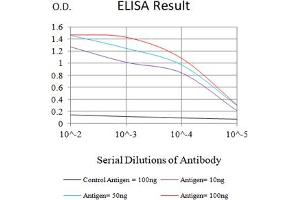 Black line: Control Antigen (100 ng),Purple line: Antigen (10 ng), Blue line: Antigen (50 ng), Red line:Antigen (100 ng) (TACI antibody)