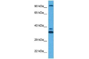 Host:  Rabbit  Target Name:  ZFX  Sample Tissue:  Human HT1080 Whole Cell  Antibody Dilution:  1ug/ml (ZFX antibody  (N-Term))