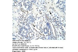 Human kidney (POGZ antibody  (N-Term))