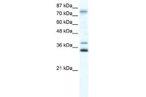 ZNF570 antibody used at 0. (ZNF570 antibody  (N-Term))
