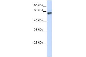 WB Suggested Anti-PHGDH Antibody Titration: 0. (PHGDH antibody  (Middle Region))