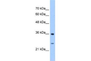 WB Suggested Anti-GSTZ1 Antibody Titration:  2. (GSTZ1 antibody  (N-Term))