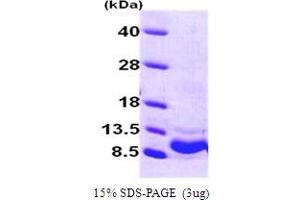 Chemokine (C-X-C Motif) Ligand 1 (Melanoma Growth Stimulating Activity, Alpha) (CXCL1) (AA 35-107) protein (His tag)