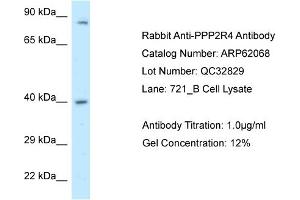 Western Blotting (WB) image for anti-Protein Phosphatase 2A Activator, Regulatory Subunit 4 (PPP2R4) (C-Term) antibody (ABIN2789006) (PPP2R4 antibody  (C-Term))