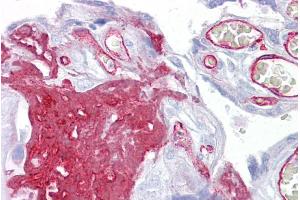 Immunohistochemistry with Placenta tissue at an antibody concentration of 5µg/ml using anti-FGG antibody (ARP44299_P050) (FGG antibody  (Middle Region))