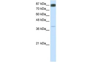 WB Suggested Anti-NFATC4 Antibody Titration:  0. (NFATC4 antibody  (N-Term))