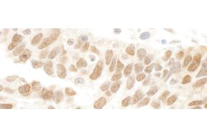 anti-Family with Sequence Similarity 175, Member A (FAM175A) (AA 400-409) antibody