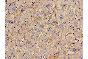 Immunohistochemistry of paraffin-embedded human liver tissue using ABIN7171513 at dilution of 1:100 (TOM1 antibody  (AA 306-487))