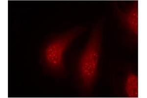 Image no. 1 for anti-Ribosomal Protein S6 Kinase, 90kDa, Polypeptide 1 (RPS6KA1) (pThr348) antibody (ABIN196796) (RPS6KA1 antibody  (pThr348))
