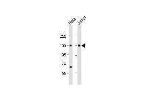 All lanes : Anti-MTUS1 Antibody (C-Term) at 1:2000 dilution Lane 1: Hela whole cell lysate Lane 2: Jurkat whole cell lysate Lysates/proteins at 20 μg per lane. (MTUS1 antibody  (AA 983-1017))