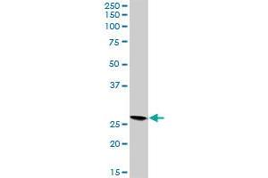 VAPB MaxPab rabbit polyclonal antibody. (VAPB antibody  (AA 1-243))