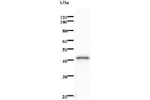 Western Blotting (WB) image for anti-Non-SMC Condensin I Complex, Subunit H (NCAPH) antibody (ABIN931216)