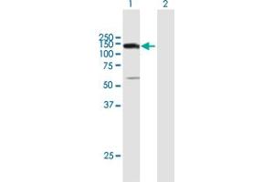 Western Blot analysis of UTP14A expression in transfected 293T cell line by UTP14A MaxPab polyclonal antibody. (UTP14A antibody  (AA 1-771))