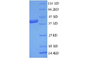 SDS-PAGE (SDS) image for Chromosome 18 Open Reading Frame 10 (C18orf10) (AA 35-354) protein (His-SUMO Tag) (ABIN4974864)